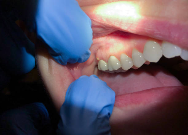 Best Emergency Dental Services for Seniors in Temple, GA