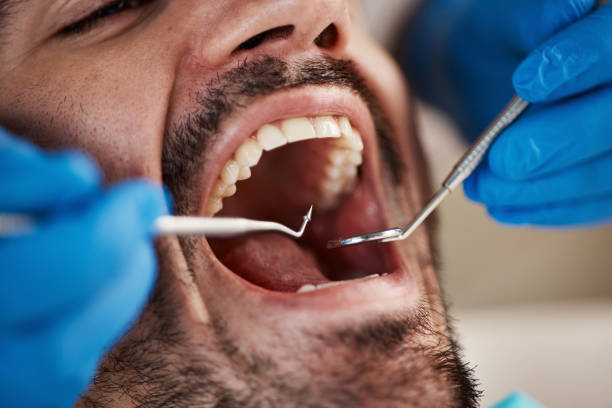 Best Pediatric Emergency Dentist in Temple, GA