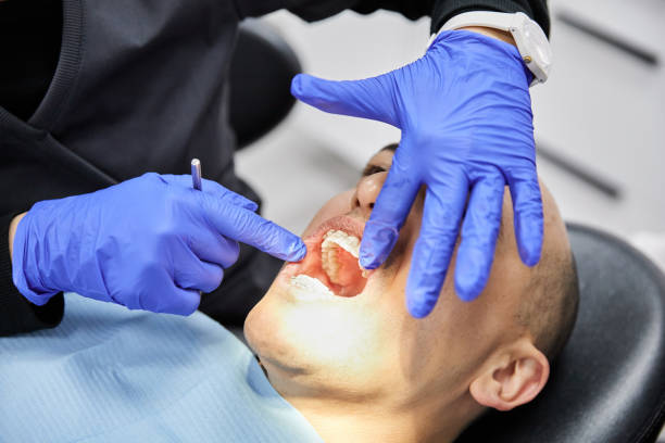 Best Emergency Dental Extractions in Temple, GA
