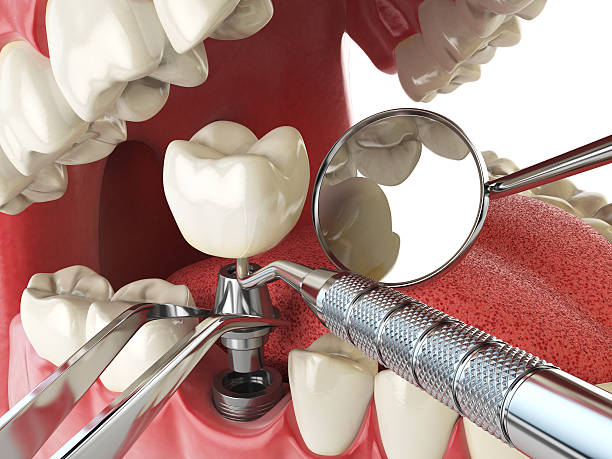 Best Mobile Emergency Dentist in Temple, GA